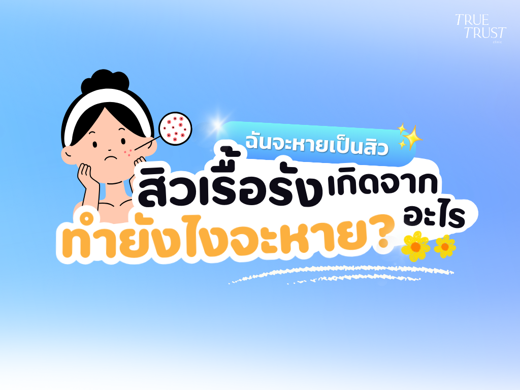 สิวเรื้อรัง