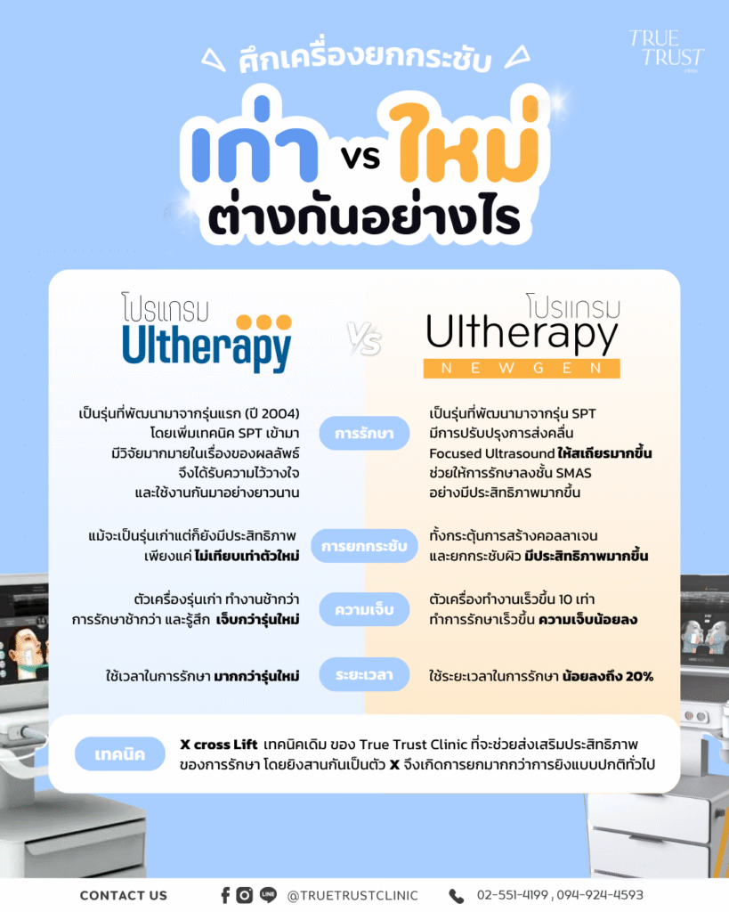 Ultherapy Prime