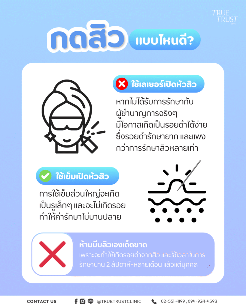 กดสิว